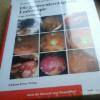 Fachbuch: Die gastroenterolische Eddoskopie
